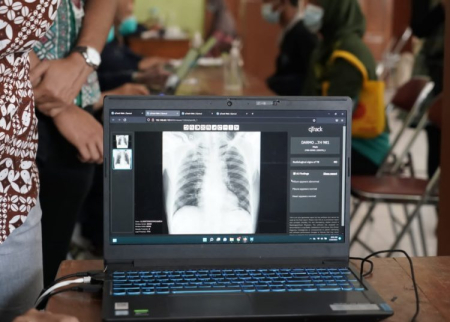 Komitmen Pemda di Yogyakarta Eliminasi TBC