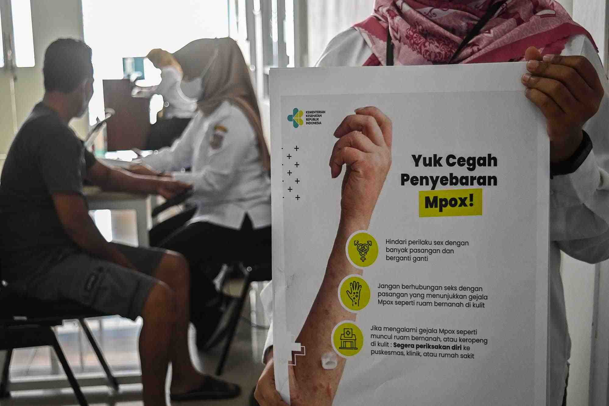 Cacar Monyet Jadi Perhatian Nasional